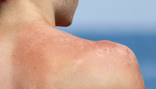 3 Major Risks when using Higher SPF in Sunscreen